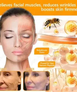 Bee Venom Senile Purpura Cream