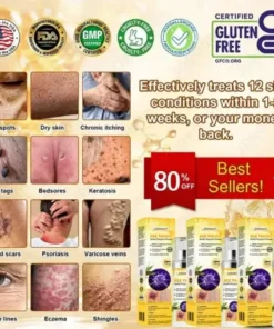 Bee Venom Senile Purpura Cream