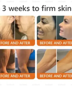 Bee Venom Skin Cream