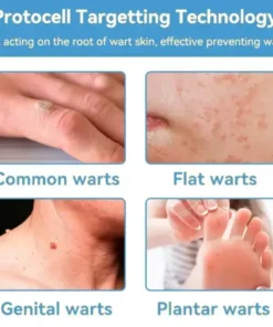 Bee Venom Skin Treatment Cream