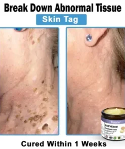 Bee Venom Skin Treatment Cream