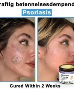 Bee Venom Skin Treatment Cream