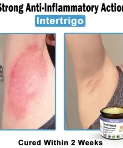 Bee Venom Skin Treatment Cream