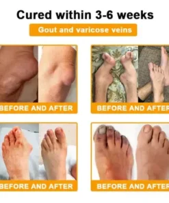 Botulinum Toxin & Bee Venom Pain-Relief Bone Healing Cream