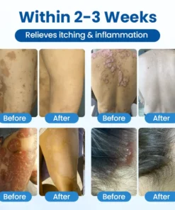 Cougex® PCA Magnesium Deep Repair Spray