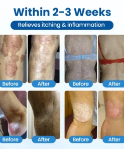 Cougex® PCA Magnesium Deep Repair Spray