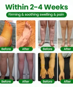 Cougex® VenoLift Leg Relief Spray