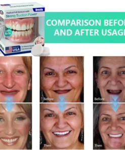 Dresfa® Medical Full Denture with Strong Suction