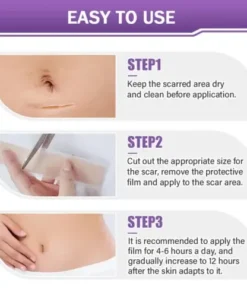 Hyaluronic Acid Nano Microneedle Repair Tape