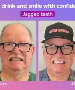 Latest Premium Comfort Dentures