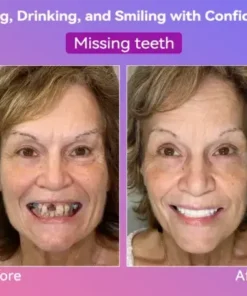 Latest Premium Comfort Dentures