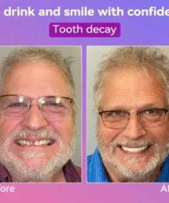 Latest Premium Comfort Dentures
