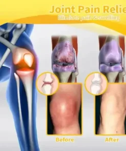 Magnesium Oil & Bee Venom Joint Healing Spray