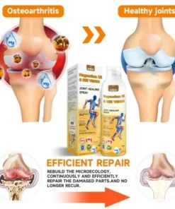 Magnesium Oil & Bee Venom Joint Healing Spray