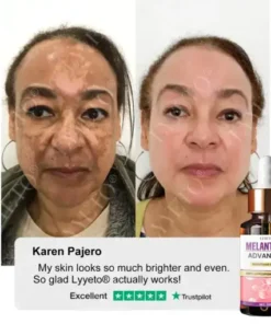 MelantraX Advanced Brightening Essence ACE