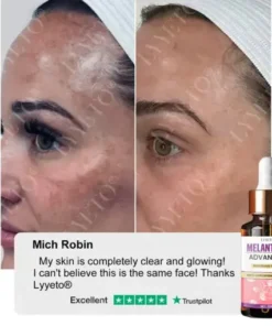 MelantraX Advanced Brightening Essence ACE