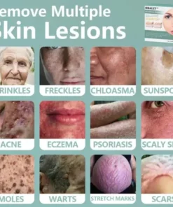 MicroNeedle Botanic skin Tag Removal Patch