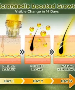 Microneedle Herbal Infusion Hair Stimulation Set