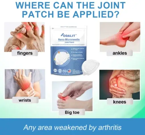 Nano-Microneedle Joint Patch