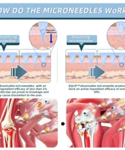 Nano-Microneedle Joint Patch