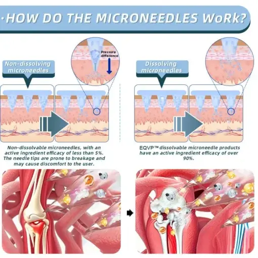Nano-Microneedle Joint Patch