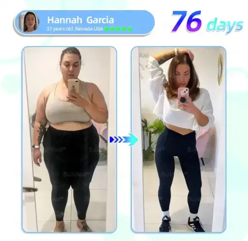 Nano-Microneedle Patch