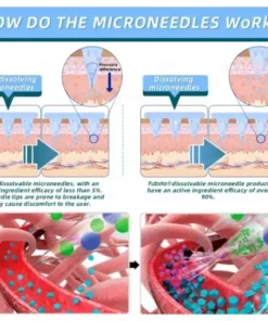 Nano-Microneedle Patch