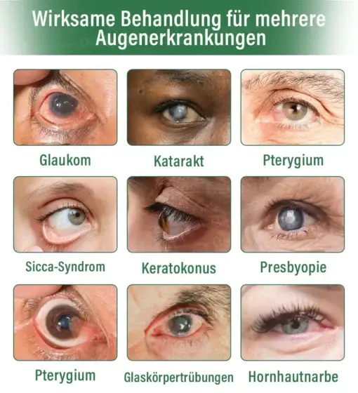 OptiClear DualTech Augentropfen