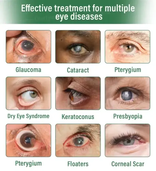 OptiClear DualTech Eye Drops