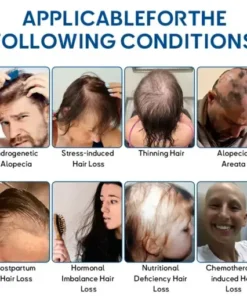 STEM Cell Hair Cycle Roller