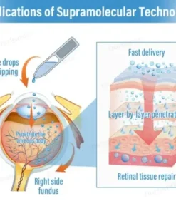 Supramolecular Eye Drops