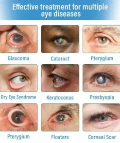 Supramolecular Eye Drops