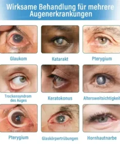 Supramolekulare Augentropfen