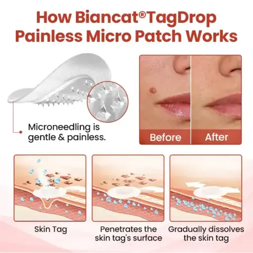 TagDrop Painless Micro Patch