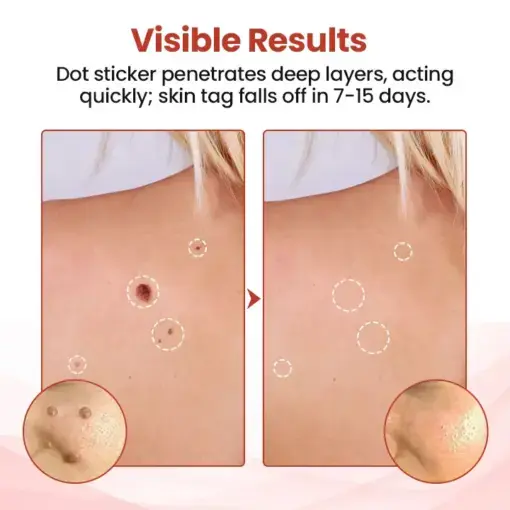 TagDrop Painless Micro Patch