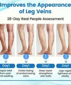 VascuCare Vein Healing Spray