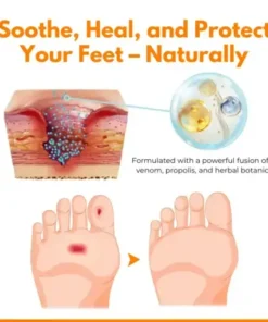 VenHeal Bee Venom Diabetic Wound Spray