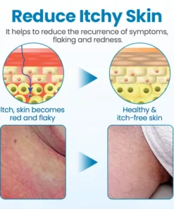 Vigoro® Men’s GentX Relief Cream