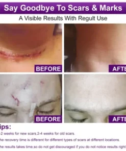 cure FACE & BODY SCAR GEL