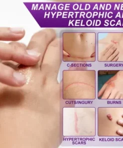 cure FACE & BODY SCAR GEL