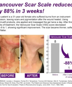 cure FACE & BODY SCAR GEL