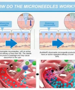𝐒limming & 𝐻ealth 𝑁ano 𝑀icroneedle 𝑃atch
