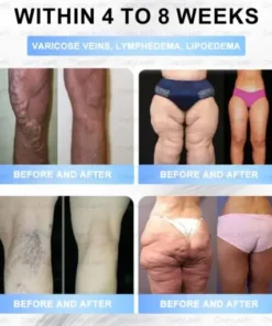 𝐒limming & 𝐻ealth 𝑁ano 𝑀icroneedle 𝑃atch