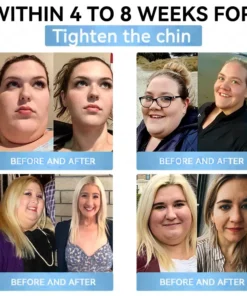 𝐑𝐨𝐩𝐜𝐞𝐞𝐫® 𝐆𝐋𝐏-𝟏 𝐏𝐫𝐨 𝐌𝐞𝐭𝐚𝐛𝐨𝐥𝐢𝐜 𝐑𝐞𝐠𝐮𝐥𝐚𝐭𝐢𝐨𝐧 𝐎𝐫𝐚𝐥 𝐒𝐩𝐫𝐚𝐲