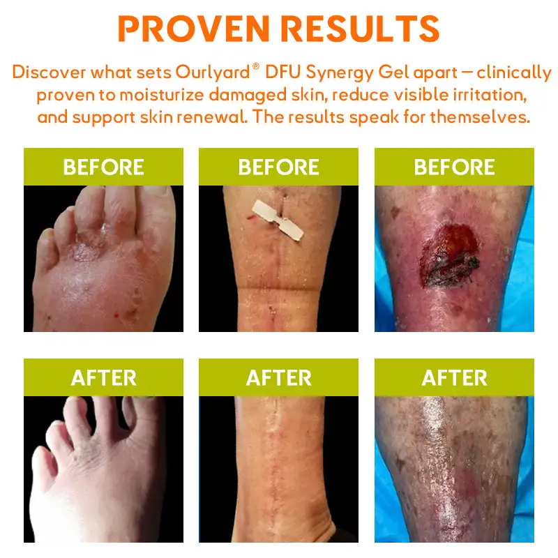 ๐๐
๐ ๐๐ฒ๐ง๐๐ซ๐ ๐ฒ ๐๐๐ฅ - Image 5