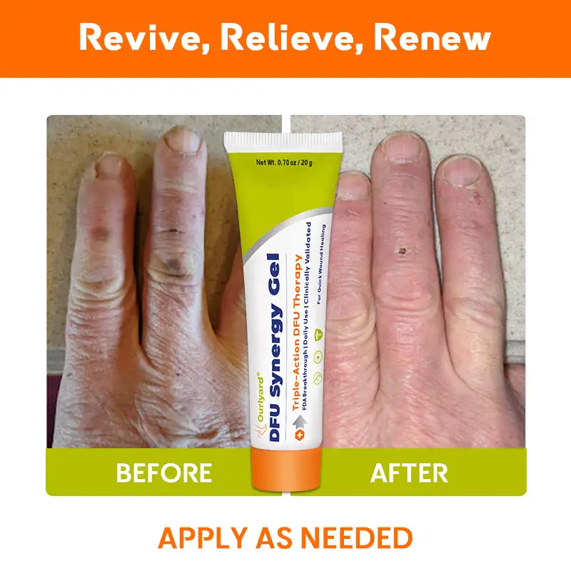 ๐๐
๐ ๐๐ฒ๐ง๐๐ซ๐ ๐ฒ ๐๐๐ฅ - Image 8