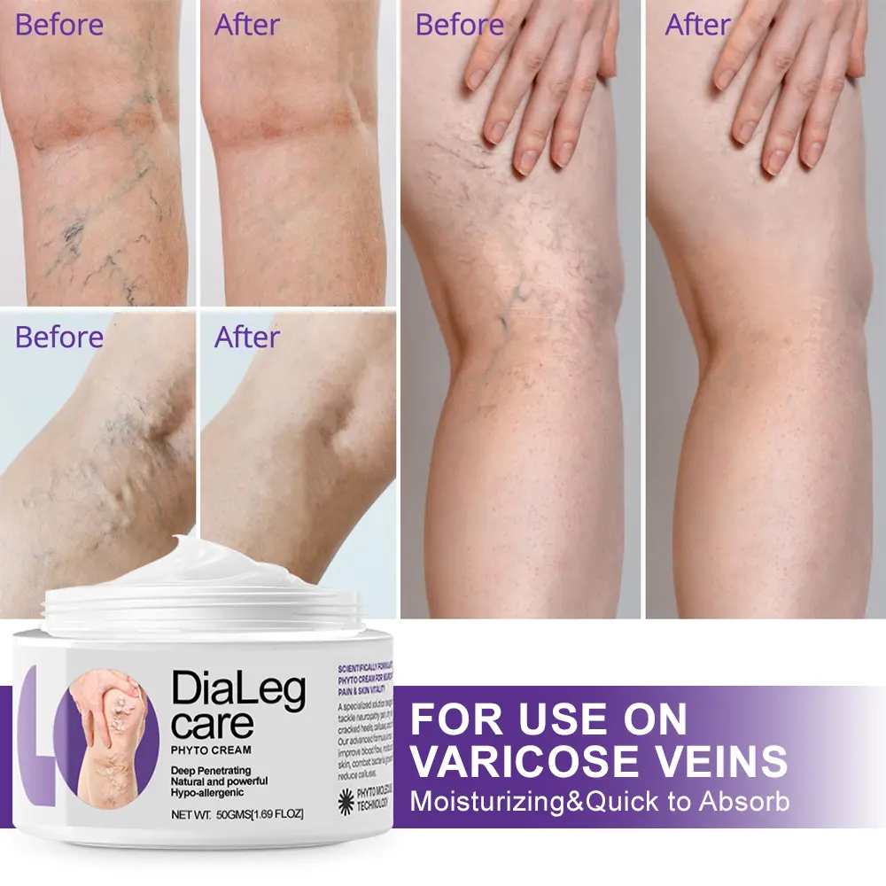 ๐๐ข๐๐๐๐ ๐๐ก๐ฒ๐ญ๐จ ๐๐ซ๐๐๐ฆ - Image 2