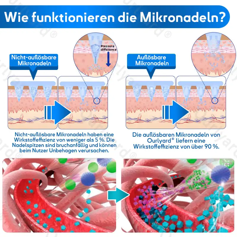 ๐๐๐ง๐จ๐ฉ๐๐ฅ๐๐ฌ๐ญ๐๐ซ - Image 10