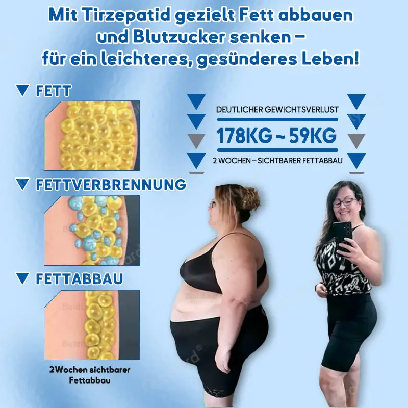 ๐๐๐ง๐จ๐ฉ๐๐ฅ๐๐ฌ๐ญ๐๐ซ - Image 2