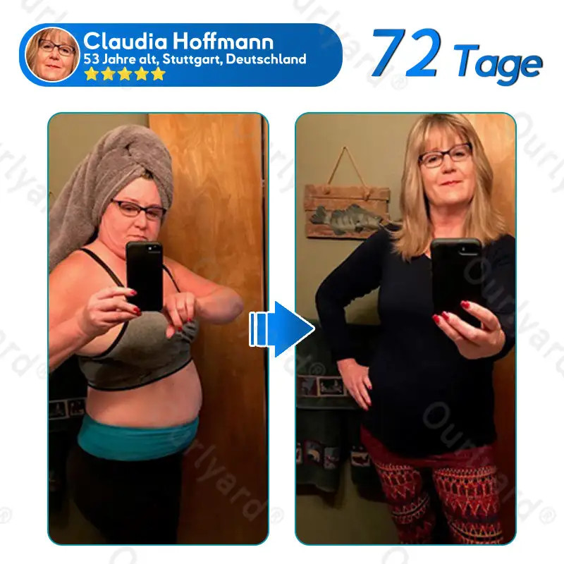 ๐๐๐ง๐จ๐ฉ๐๐ฅ๐๐ฌ๐ญ๐๐ซ - Image 4